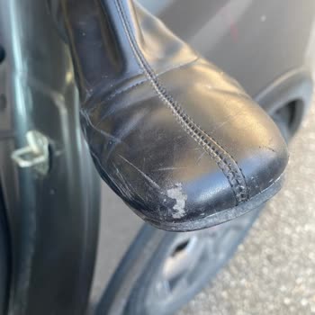 Botta Topuk Kırılması Ve Mağazanın Kullanıcı Hatası İddiası