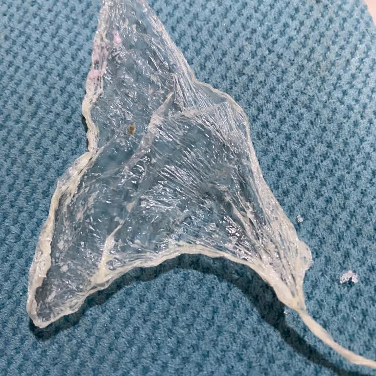 Trendyol Yemek'te Abbas Waffle Kumpirde Plastik Parçası Bulunması Sağlık Riski