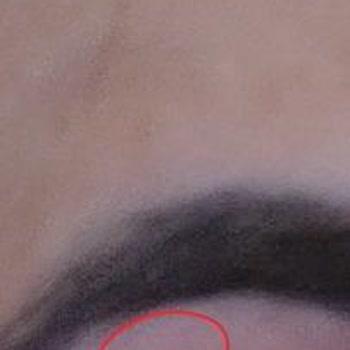 Kalın Kaş Talebim İhmal Edildi Ve İşlem Sonrası Kaşlar İnceltilip Ciltte Kanama Oluştu