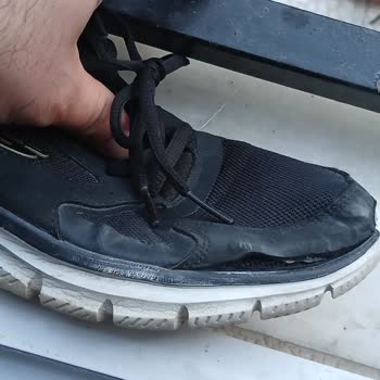 Az Kullanılmış Skechers Ayakkabıda Açılma Sorunu Ve Üretici Hatası İddiası