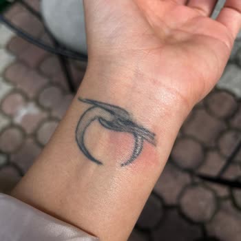 Kardelen Lazer Uygulamasında Yanma Ve Dövme Hasarı