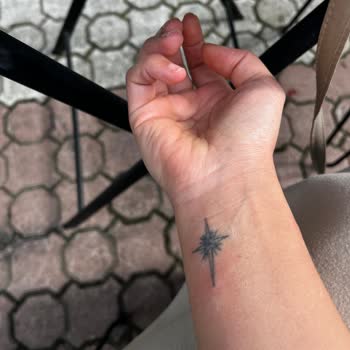 Kardelen Lazer Uygulamasında Yanma Ve Dövme Hasarı