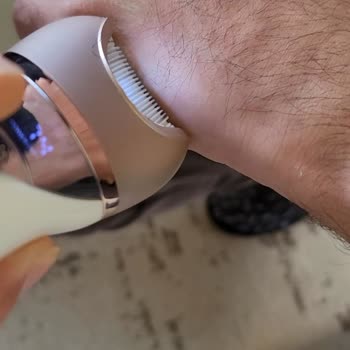 Çalışmayan Epilatör Ve İade Talebinin Reddedilmesi