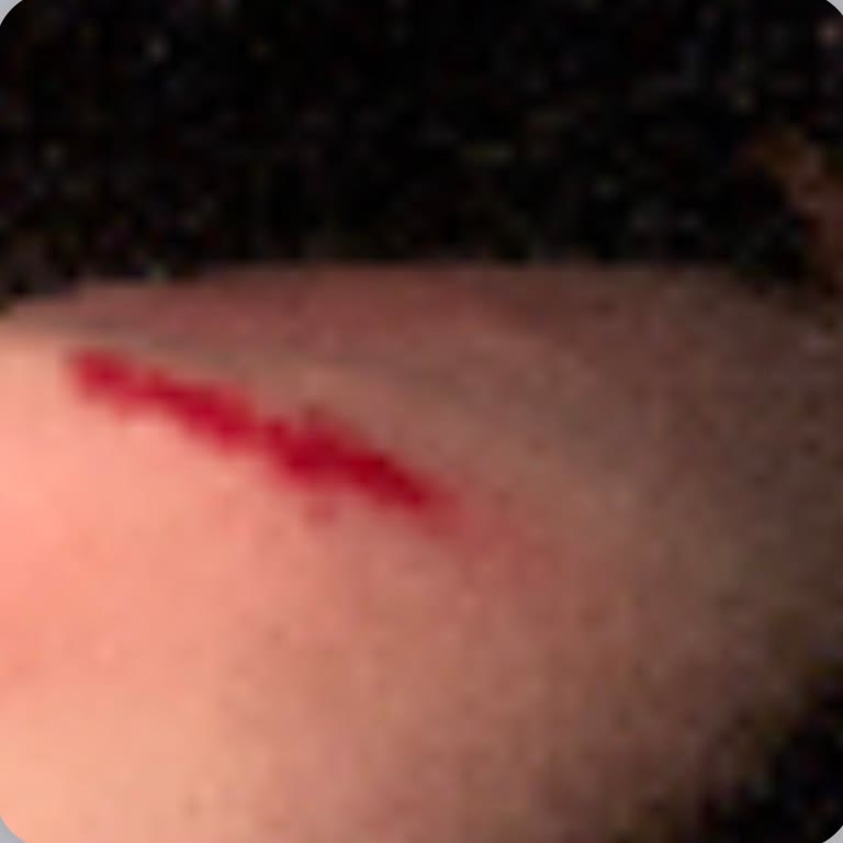 Kontrolsüz Otobüs Hareketi Sonrası Yaralanma Ve İlgisiz Davranış