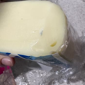 İçim Kaşarında Yabancı Cisim Ve Küf: Tekrarlayan Hijyen Sorunu