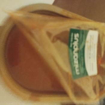 Getir'den Aldığım Çorba Zehirlenmesi Sonucu 13 Bin TL Hastane Masrafı