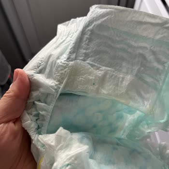 Prima Bebek Bezi Üzerinde Yapışkan Kalıntı Ve Katı Cisim Sorunu