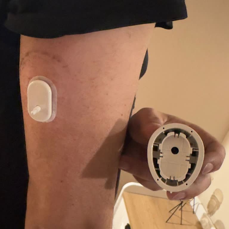 Arızalı CGM Sensörü Kanamaya Neden Oldu, Sağlık Riski Ve Ücretsiz Değişim Talebi