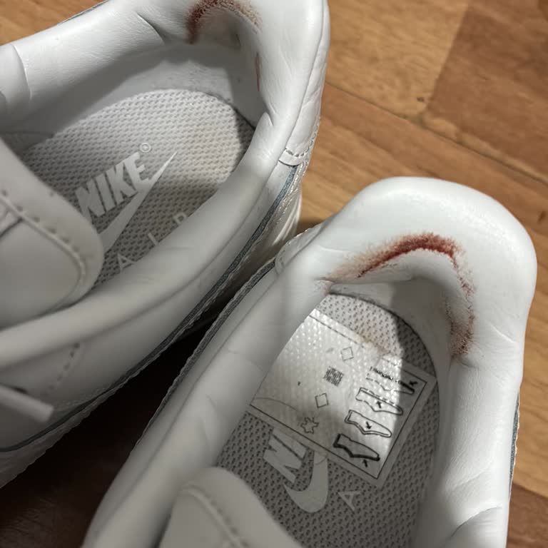 Nike Air Force 1 Ayakkabım Tek Kullanımda Ağır Topuk Yaralanması Yaptı, İade Talebim Reddedildi