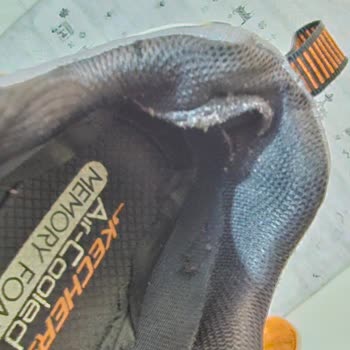 Garanti Kapsamındaki Skechers Ayakkabımda Yırtılma Ve Koku, Kullanıcı Hatası İddiası