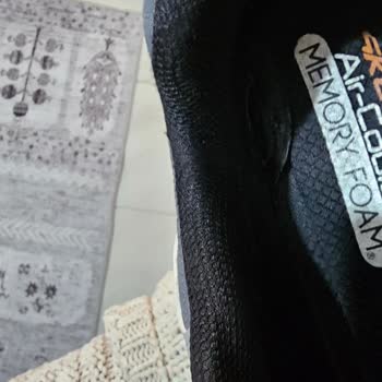 Garanti Kapsamındaki Skechers Ayakkabımda Yırtılma Ve Koku, Kullanıcı Hatası İddiası