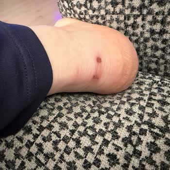 İyaş Mağazasında Alınan Ayakkabının Sürekli Ayağa Vurması Ve İade Talebi