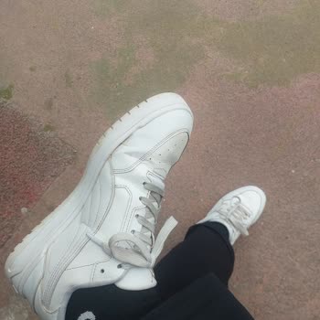 Ayakkabının Bir Ay İçinde Açılması Ve Trendyol’da Yanıt Bulamama