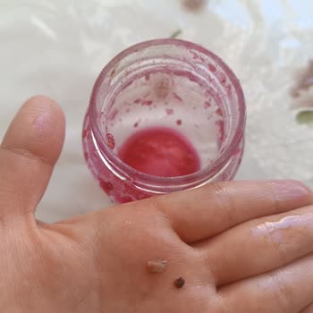 Ahududu Reçelinde Taşlar Diş Dolgusu Kaybına Sebep Oldu