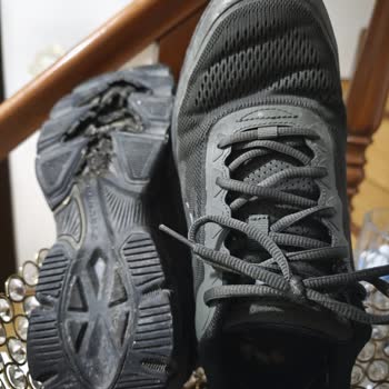 Skechers Ayakkabıda Üretim Hatası, Kullanıcı Hatası Reddi Ve Ücret İadesi Talebi