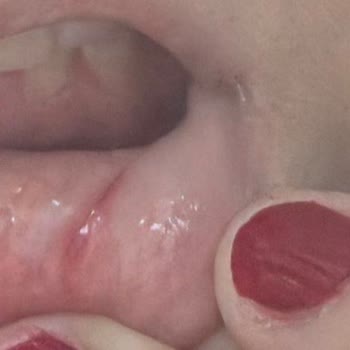 Migros’tan Servet Antep Fıstığı Kremasından Çıkan Cam Benzeri Parça Ağzımı Kesti