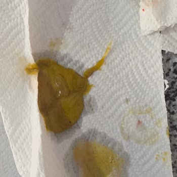 Migros’tan Servet Antep Fıstığı Kremasından Çıkan Cam Benzeri Parça Ağzımı Kesti