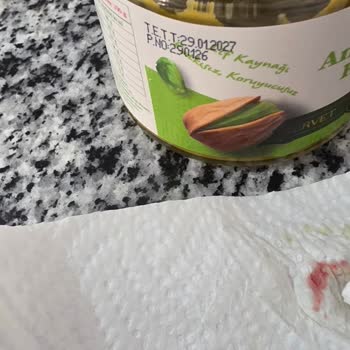 Migros’tan Servet Antep Fıstığı Kremasından Çıkan Cam Benzeri Parça Ağzımı Kesti