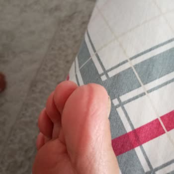 Ayakkabı Yararak Ayak Yaraladı, Mağaza Sorumluluğu Reddetti