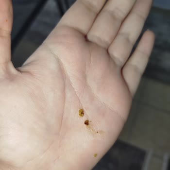 Sebzeli Noodle’da Yabancı Cisim Ve Rahatsız Edici Koku