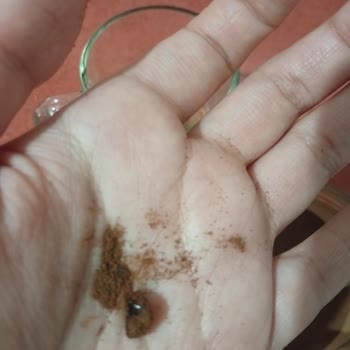 Hindiba Kahvesi'nde Plastik Parça Bulunması Sağlık Endişesi Ve Cevapsız Yanıt