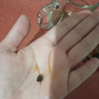 Hindiba Kahvesi'nde Plastik Parça Bulunması Sağlık Endişesi Ve Cevapsız Yanıt