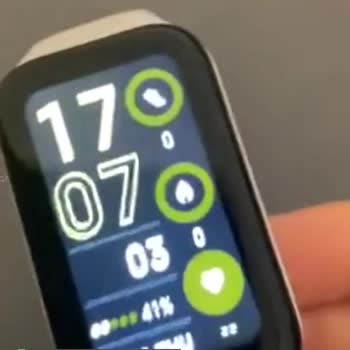Xiaomi Mi Band 2 Ekran Çiziği Ve Kordon Arkası Çıkması