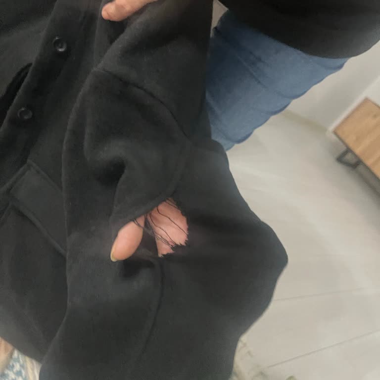 Vena Cekette Dikişler Kendiliğinden Sökülerek Kullanılamaz Duruma Geldi