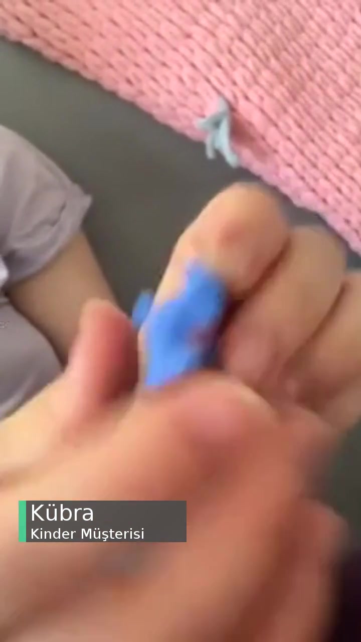 Kinder İç İçe Geçmeyen Oyuncak videonun kapak resmi