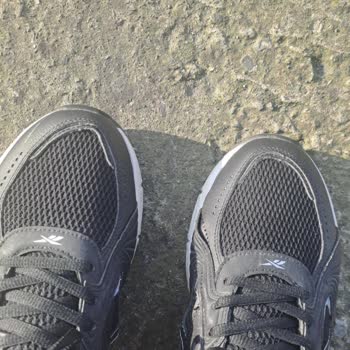 Pazarama Ve Koray Spor’un Kullanıcı Hatası İddiası Üzerine Reebok Ayakkabısının Hızlı Deformasyonu