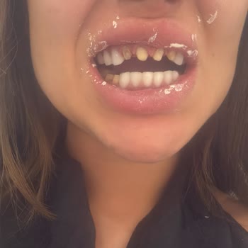 Han's Aesthetic Yaşadığım Mağduriyet