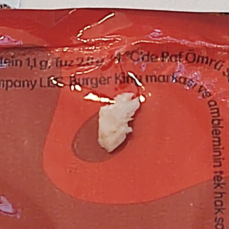 Burger King Ekonomik Köfte Burgerde Kemik Parçası Çıktı Ve Boğazıma Baktı