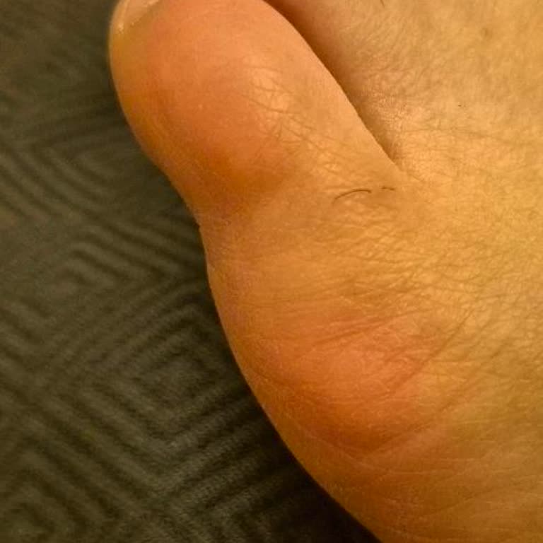 Skechers Botunun Ayağıma Sıkması Ve Mağazanın Cevapsız Tutumu