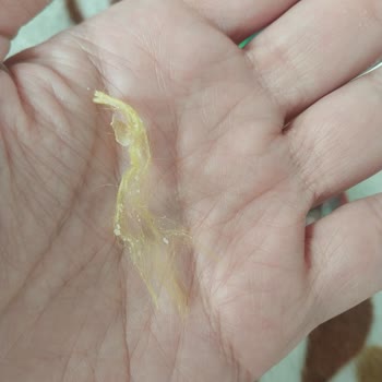 P***** Yer Fıstığı Paketi İçinde Saç Bulunması Üretim Hijyeni Endişesi