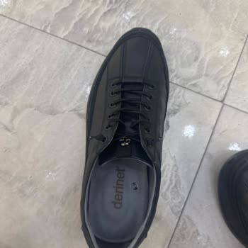 Ayakkabının Arka Kısmındaki Ağrı Ve Su Toplanması Nedeniyle Ücret İadesi Talebi