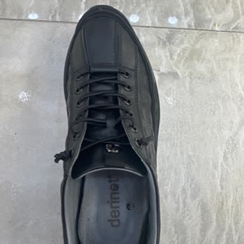 Ayakkabının Arka Kısmındaki Ağrı Ve Su Toplanması Nedeniyle Ücret İadesi Talebi