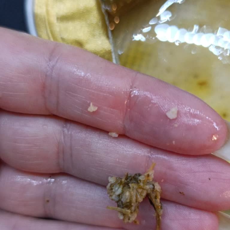 Burcu Sarma Ürününde Taş Bulunması Diş Dolgusunu Kırdı