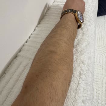 Eva Vip Güzellik Salonu (Erzurum) Verilen Garantiler Yetersiz: Ağrılı Ve Sonuçsuz Lazer Seansları