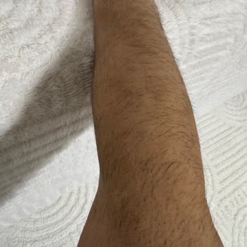 Eva Vip Güzellik Salonu (Erzurum) Verilen Garantiler Yetersiz: Ağrılı Ve Sonuçsuz Lazer Seansları