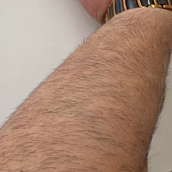 Eva Vip Güzellik Salonu (Erzurum) Verilen Garantiler Yetersiz: Ağrılı Ve Sonuçsuz Lazer Seansları