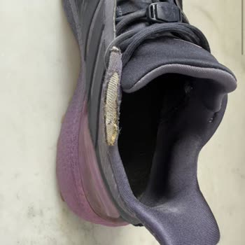 57 Günde Adidas Ayakkabısının Kaplaması Soyuldu Ve Kumaşı Yırtıldı