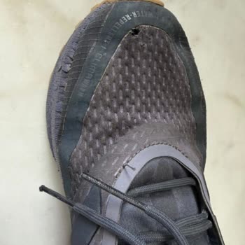 57 Günde Adidas Ayakkabısının Kaplaması Soyuldu Ve Kumaşı Yırtıldı