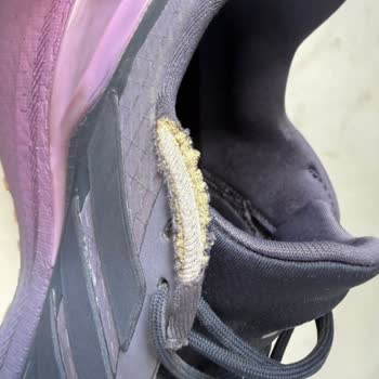 57 Günde Adidas Ayakkabısının Kaplaması Soyuldu Ve Kumaşı Yırtıldı