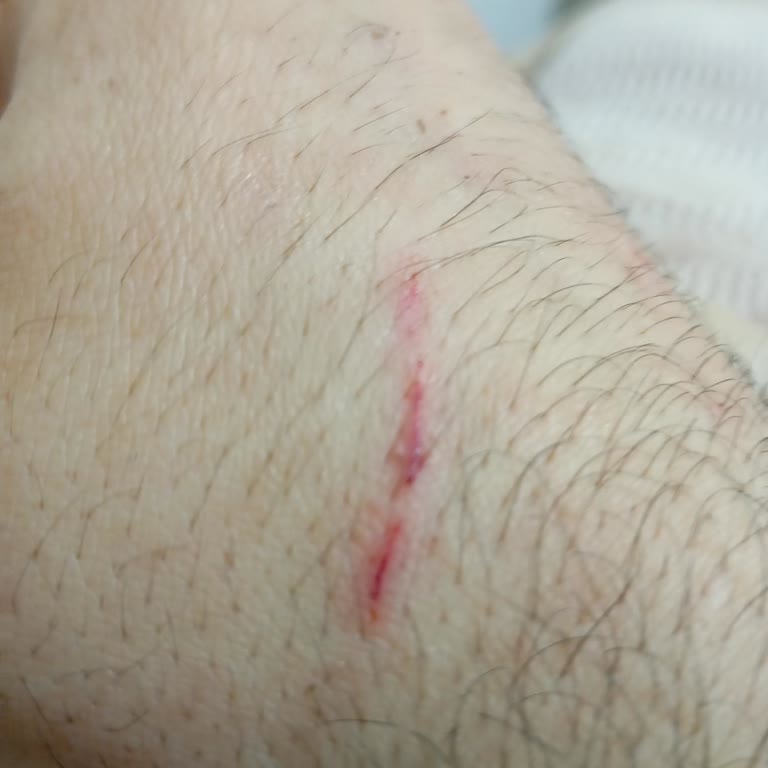 Veterinerin Sert Yaklaşımı Ve Kedimde Aşı Sırasında Yaşanan Stres