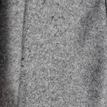 Mango Cekette Aşırı Tüylenme, Şikayetime Çözüm Sunulmadı