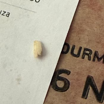 Dürümle Şubesinde Kemik Parçası Bulundu, Personel Umursamaz