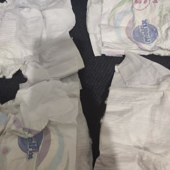 Molfix Bebek Bezinde Kesik Bel Bölgesi Ve Müşteri Hizmetinden Cevapsızlık