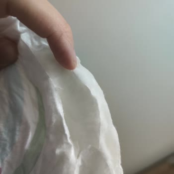 Molfix Bebek Bezinde Kesik Bel Bölgesi Ve Müşteri Hizmetinden Cevapsızlık