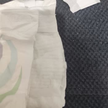 Molfix Bebek Bezinde Kesik Bel Bölgesi Ve Müşteri Hizmetinden Cevapsızlık