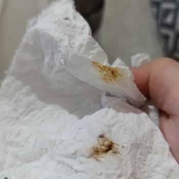 Nebulizatör Paslı Akıntısı Ve Sağlık Riski